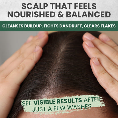 Tea Tree Shampoo & Conditioner MaxTherapy Set – Itchy Scalp & Clarifying Care, 16 oz